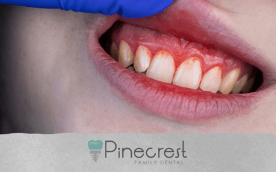 Understanding and Preventing Gum Disease: Insights from Pinecrest Family Dental